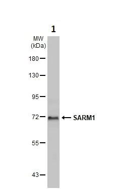 Western blot - Anti-SARM antibody (AB226930)