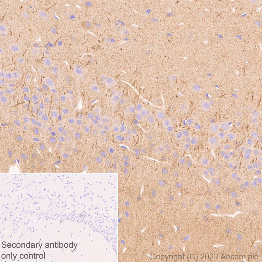Immunohistochemistry (Formalin/PFA-fixed paraffin-embedded sections) - Anti-SARM1 antibody [EPR24834-80] (AB309195), expandable thumbnail