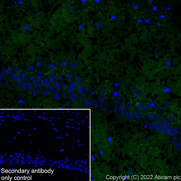 Immunohistochemistry (Frozen sections) - Anti-SARM1 antibody [EPR24834-80] (ab309195), expandable thumbnail