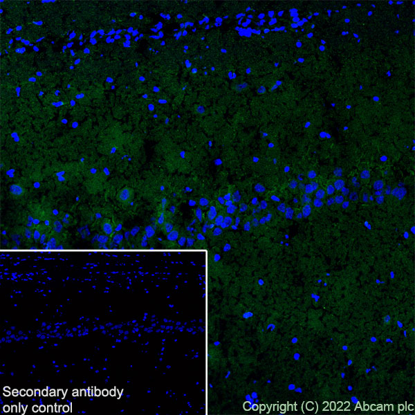 Immunohistochemistry (Frozen sections) - Anti-SARM1 antibody [EPR24834-80] (ab309195), expandable thumbnail