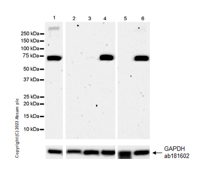 Western blot - Anti-SARM1 antibody [EPR24834-80] (ab309195), expandable thumbnail