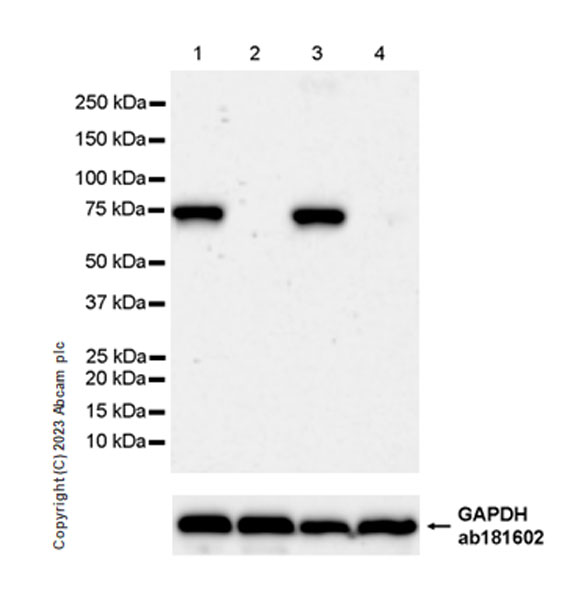 Western blot - Anti-SARM1 antibody [EPR24834-80] (ab309195), expandable thumbnail