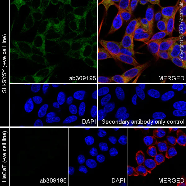 Immunocytochemistry/ Immunofluorescence - Anti-SARM1 antibody [EPR24834-80] - BSA and Azide free (AB309196)