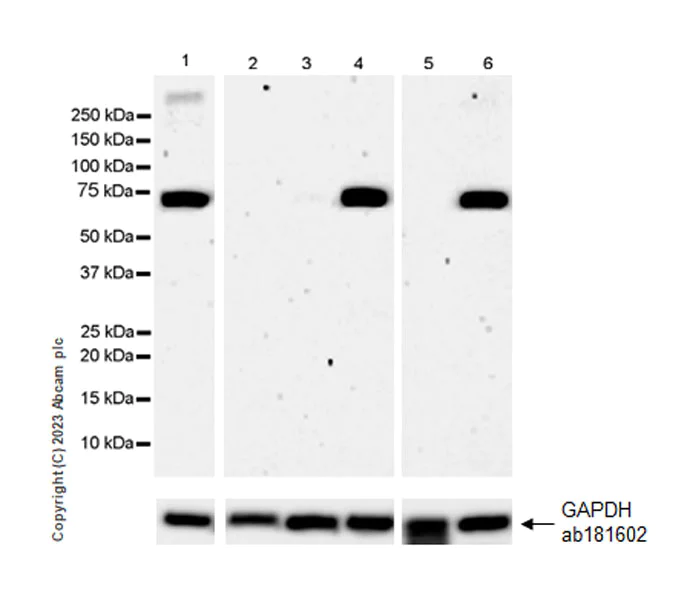 Western blot - Anti-SARM1 antibody [EPR24834-80] - BSA and Azide free (AB309196)