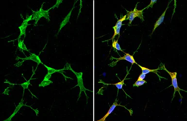 Immunocytochemistry/ Immunofluorescence - Anti-SARM1 antibody [HL1066] (AB307496)