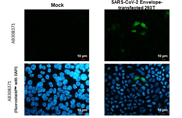 Immunocytochemistry/ Immunofluorescence - Anti-SARS CoV 2 COVID 19 Envelope antibody [HL1443] (AB308371), expandable thumbnail