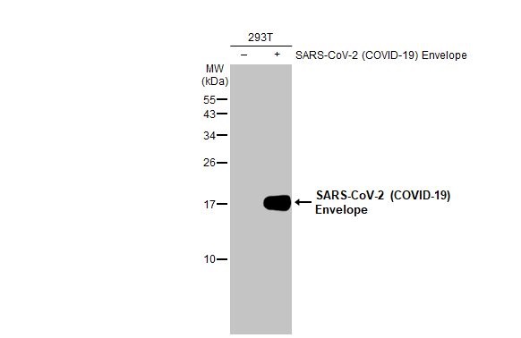 Western blot - Anti-SARS CoV 2 COVID 19 Envelope antibody [HL1443] (AB308371), expandable thumbnail