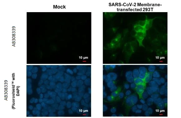 Immunocytochemistry/ Immunofluorescence - Anti-SARS CoV 2 COVID 19 Membrane antibody [HL1087] (AB308339)