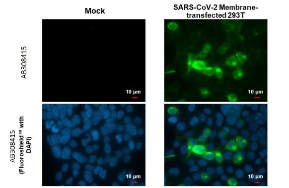Immunocytochemistry/ Immunofluorescence - Anti-SARS CoV 2 (COVID 19) Membrane antibody [HL1088] (AB308415), expandable thumbnail
