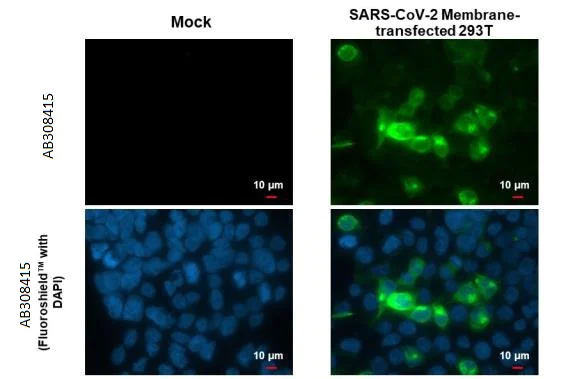 Immunocytochemistry/ Immunofluorescence - Anti-SARS CoV 2 (COVID 19) Membrane antibody [HL1088] (AB308415)