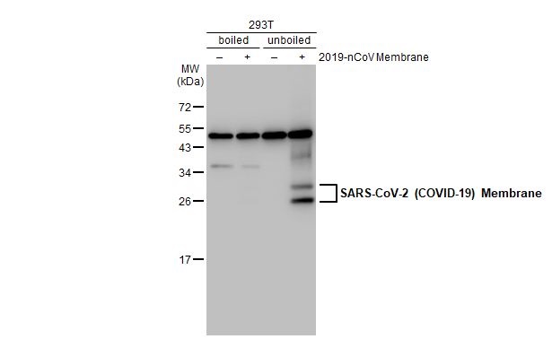 Western blot - Anti-SARS CoV 2 (COVID 19) Membrane antibody [HL1088] (AB308415), expandable thumbnail