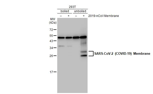 Western blot - Anti-SARS CoV 2 (COVID 19) Membrane antibody [HL1088] (AB308415)