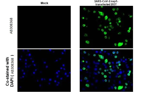 Immunohistochemistry (Formalin/PFA-fixed paraffin-embedded sections) - Anti-SARS CoV 2 COVID 19 nsp1 antibody [HL1435] (AB308368), expandable thumbnail
