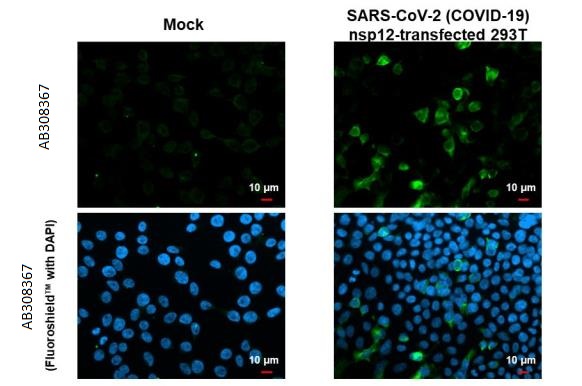 Immunocytochemistry/ Immunofluorescence - Anti-SARS CoV 2 COVID 19 nsp12 antibody [HL1415] (AB308367), expandable thumbnail