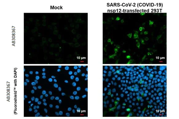 Immunocytochemistry/ Immunofluorescence - Anti-SARS CoV 2 COVID 19 nsp12 antibody [HL1415] (AB308367)