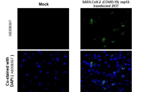 Immunohistochemistry (Formalin/PFA-fixed paraffin-embedded sections) - Anti-SARS CoV 2 COVID 19 nsp12 antibody [HL1415] (AB308367), expandable thumbnail