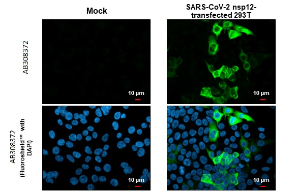 Immunocytochemistry/ Immunofluorescence - Anti-SARS CoV 2 COVID 19 nsp12 RdRP antibody [HL1444] (AB308372), expandable thumbnail