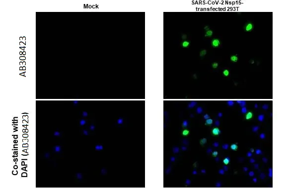 Immunohistochemistry (Formalin/PFA-fixed paraffin-embedded sections) - Anti-SARS CoV 2 (COVID 19) nsp15 antibody [HL1446] (AB308423)