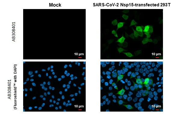 Immunocytochemistry/ Immunofluorescence - Anti-SARS CoV 2 (COVID 19) nsp15 antibody [HL1760] (AB308401)
