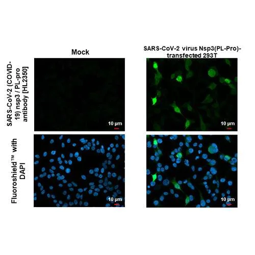 Immunocytochemistry/ Immunofluorescence - Anti-SARS-CoV-2 (COVID-19) nsp3 / PL-pro antibody [HL2350] (AB317206)
