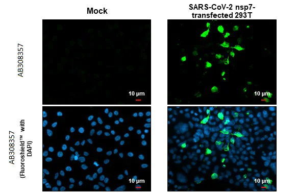 Immunocytochemistry/ Immunofluorescence - Anti-SARS CoV 2 COVID 19 nsp7 antibody [HL1301] (AB308357)