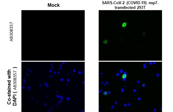 Immunohistochemistry (Formalin/PFA-fixed paraffin-embedded sections) - Anti-SARS CoV 2 COVID 19 nsp7 antibody [HL1301] (AB308357)