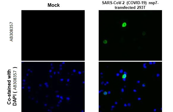 Immunohistochemistry (Formalin/PFA-fixed paraffin-embedded sections) - Anti-SARS CoV 2 COVID 19 nsp7 antibody [HL1301] (AB308357)