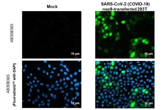 Immunocytochemistry/ Immunofluorescence - Anti-SARS CoV 2 COVID 19 nsp9 antibody [HL1399] (AB308365)
