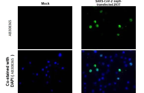 Immunohistochemistry (Formalin/PFA-fixed paraffin-embedded sections) - Anti-SARS CoV 2 COVID 19 nsp9 antibody [HL1399] (AB308365), expandable thumbnail