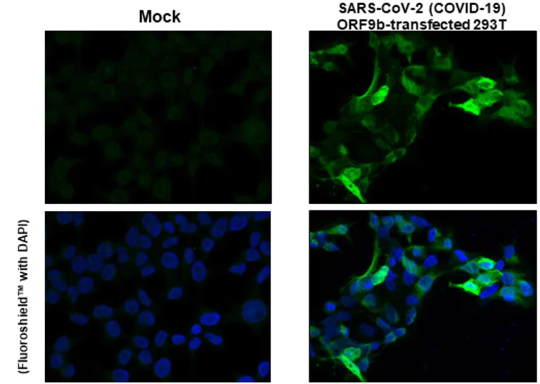 Immunocytochemistry/ Immunofluorescence - Anti-SARS-CoV-2 (COVID-19) ORF9b antibody [HL1917] (AB308204)