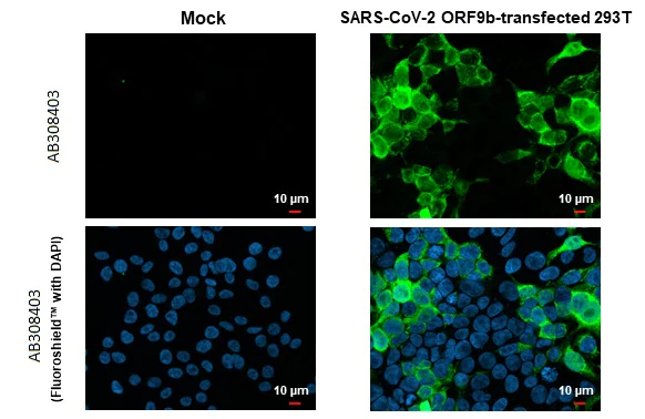 Immunocytochemistry/ Immunofluorescence - Anti-SARS CoV 2 (COVID 19) ORF9b antibody [HL1918] (AB308403)
