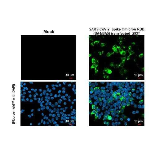 Immunocytochemistry/ Immunofluorescence - Anti-SARS-CoV-2 (COVID-19) Spike RBD Omicron antibody [HL1866] (AB317115)