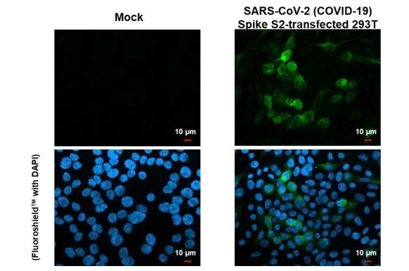 Immunocytochemistry/ Immunofluorescence - Anti-SARS CoV 2 (COVID 19) Spike S2 antibody [HL1038] (AB308412)