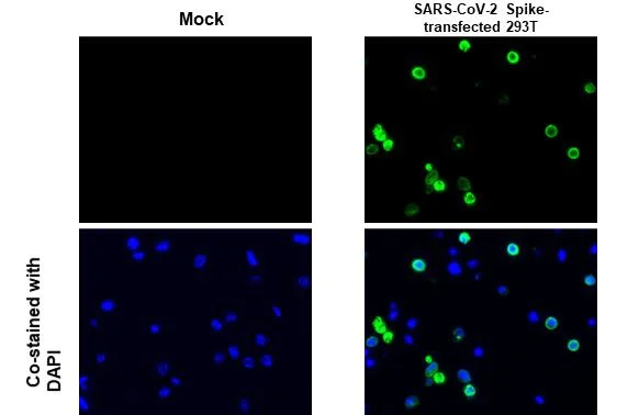 Immunohistochemistry paraffin embedded sections - Anti-SARS CoV 2 (COVID 19) Spike S2 antibody [HL1038] (AB308412)