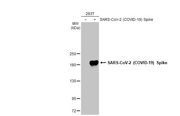 Western blot - Anti-SARS CoV 2 (COVID 19) Spike S2 antibody [HL1038] (AB308412), expandable thumbnail