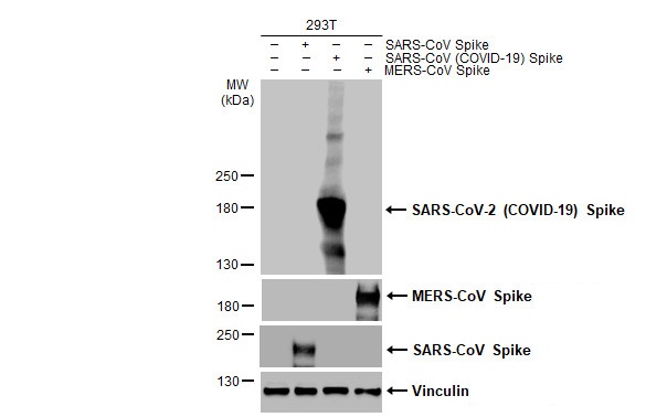 Western blot - Anti-SARS CoV 2 (COVID 19) Spike S2 antibody [HL1038] (AB308412), expandable thumbnail