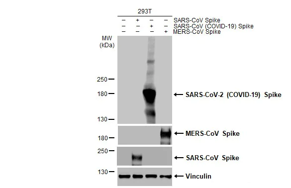 Western blot - Anti-SARS CoV 2 (COVID 19) Spike S2 antibody [HL1038] (AB308412)