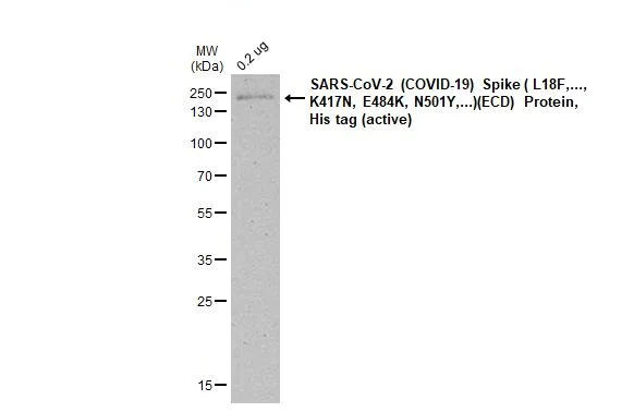 Western blot - Anti-SARS CoV 2 (COVID 19) Spike S2 antibody [HL1038] (AB308412)