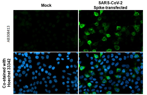 Immunocytochemistry/ Immunofluorescence - Anti-SARS CoV 2 (COVID 19) Spike S2 / S2' antibody [HL1039] (AB308413), expandable thumbnail