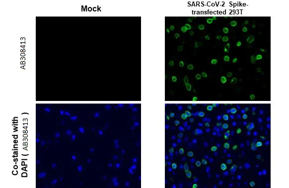 Immunohistochemistry (Formalin/PFA-fixed paraffin-embedded sections) - Anti-SARS CoV 2 (COVID 19) Spike S2 / S2' antibody [HL1039] (AB308413)