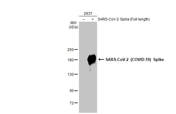 Western blot - Anti-SARS CoV 2 (COVID 19) Spike S2 / S2' antibody [HL1039] (AB308413), expandable thumbnail