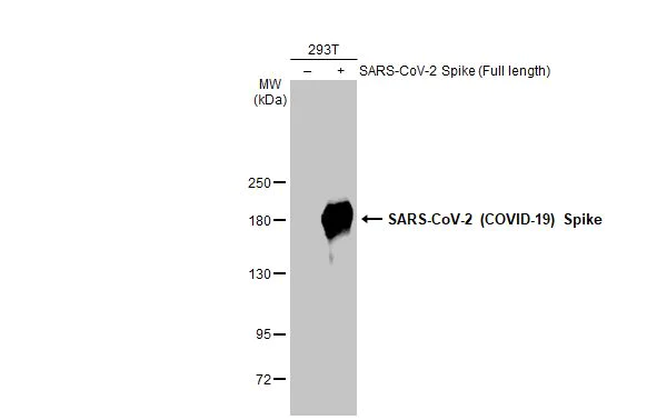 Western blot - Anti-SARS CoV 2 (COVID 19) Spike S2 / S2' antibody [HL1039] (AB308413)