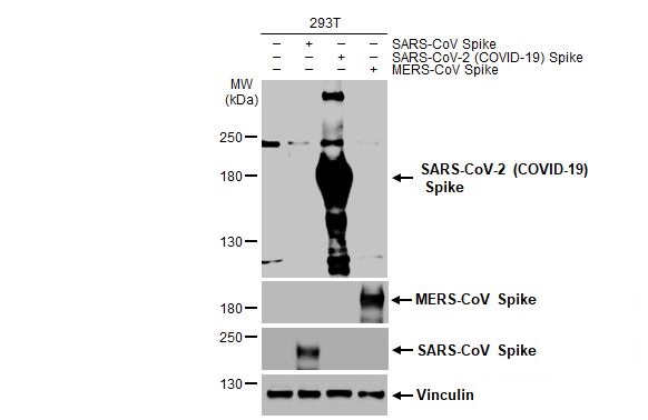 Western blot - Anti-SARS CoV 2 (COVID 19) Spike S2 / S2' antibody [HL1039] (AB308413), expandable thumbnail