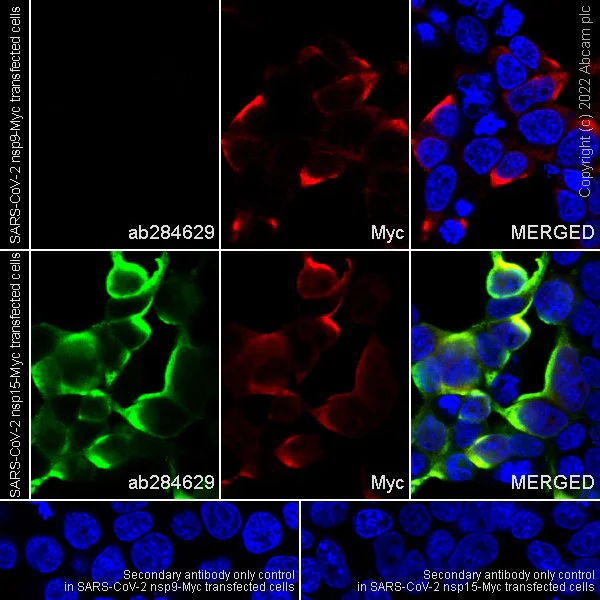 Immunocytochemistry/ Immunofluorescence - Anti-SARS-CoV-2 nsp15 antibody [EPR24840-74] - BSA and Azide free (AB284630)