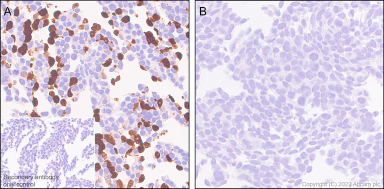 Immunohistochemistry (Formalin/PFA-fixed paraffin-embedded sections) - Anti-SARS-CoV-2 nsp15 antibody [EPR24840-74] - BSA and Azide free (AB284630)