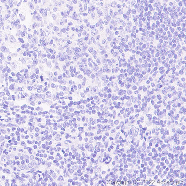Immunohistochemistry (Formalin/PFA-fixed paraffin-embedded sections) - Anti-SARS-CoV-2 nsp15 antibody [EPR24840-74] - BSA and Azide free (AB284630)