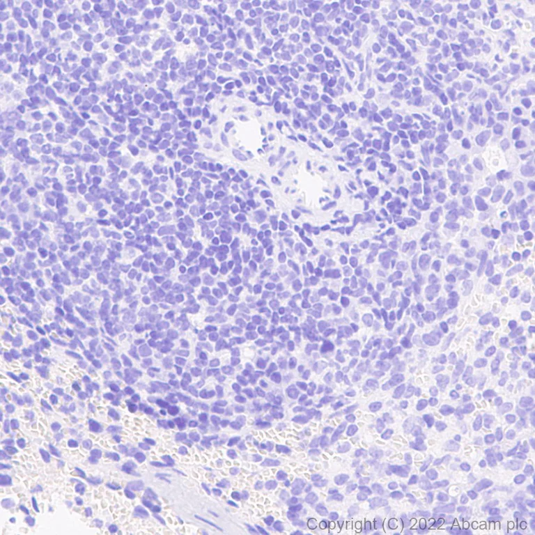 Immunohistochemistry (Formalin/PFA-fixed paraffin-embedded sections) - Anti-SARS-CoV-2 nsp15 antibody [EPR24840-74] - BSA and Azide free (AB284630)