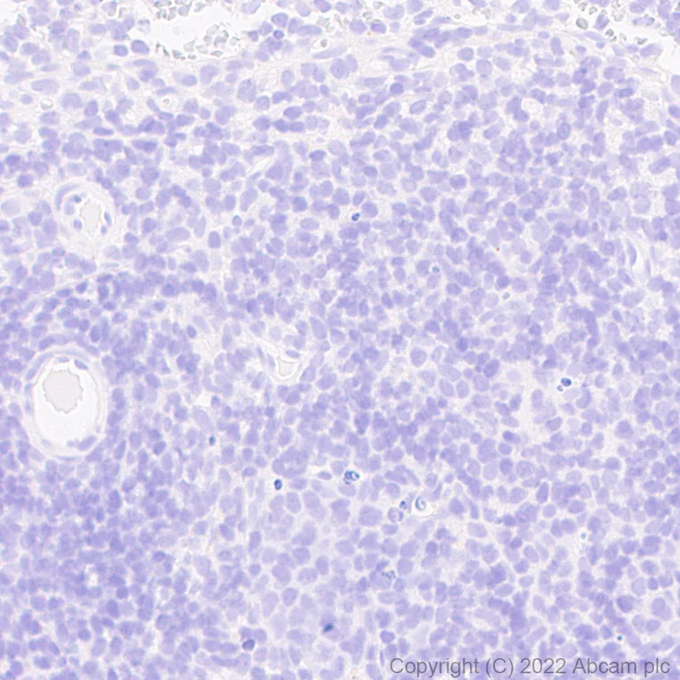 Immunohistochemistry (Formalin/PFA-fixed paraffin-embedded sections) - Anti-SARS-CoV-2 nsp15 antibody [EPR24840-74] - BSA and Azide free (AB284630)