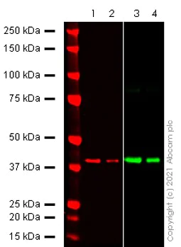 Western blot - Anti-SARS-CoV-2 nsp15 antibody [EPR24840-74] - BSA and Azide free (AB284630)