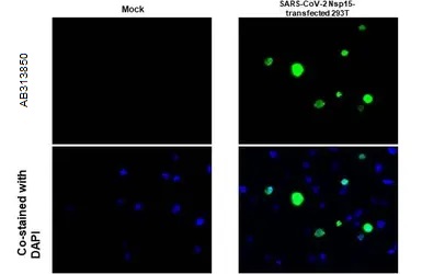 Immunohistochemistry (Formalin/PFA-fixed paraffin-embedded sections) - Anti-SARS-CoV-2 nsp15 antibody [HL1445] - BSA and Azide free (AB313850), expandable thumbnail
